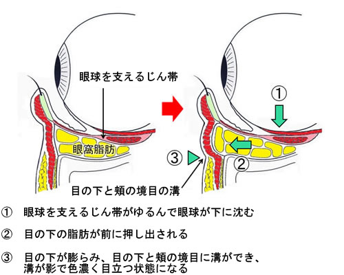 ڂ̉摜